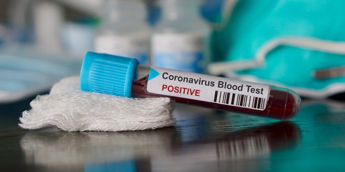 Coronavirus Positive