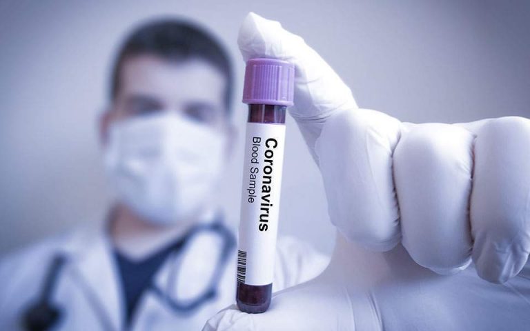 Coronavirus Test