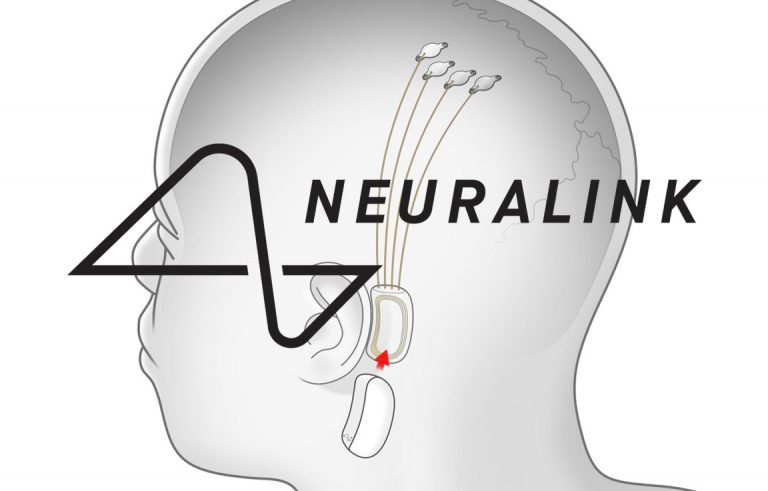 Neuralink: Κατηγορείται για πειράματα – βασανιστήρια σε πιθήκους