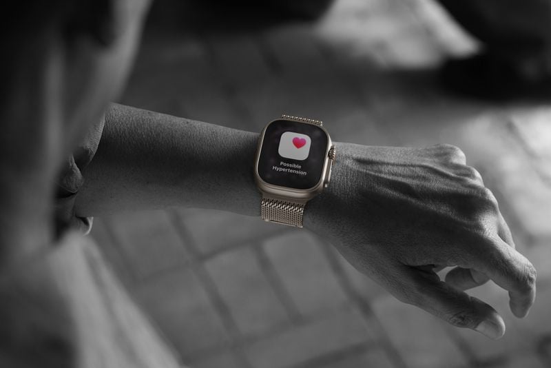 Apple Watch Ultra 3, Apple Watch Ultra 3: Επίσημο με τη μεγαλύτερη οθόνη που κυκλοφόρησε ποτέ, 5G και δορυφορική συνδεσιμότητα